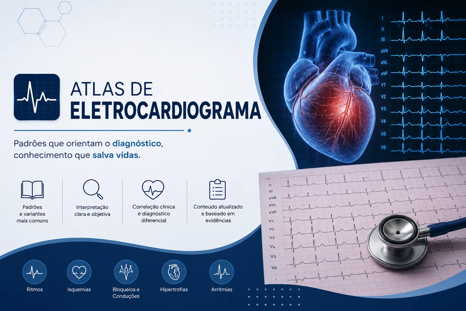 Atlas de Eletrocardiograma