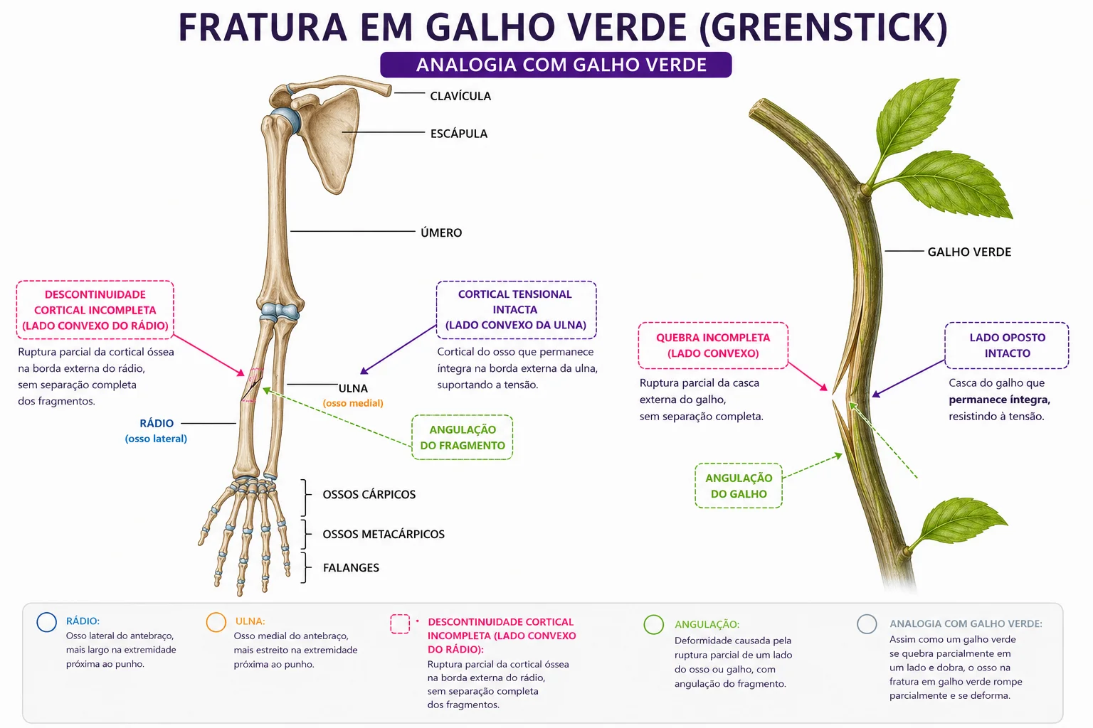 Diagrama da Fratura em Galho Verde