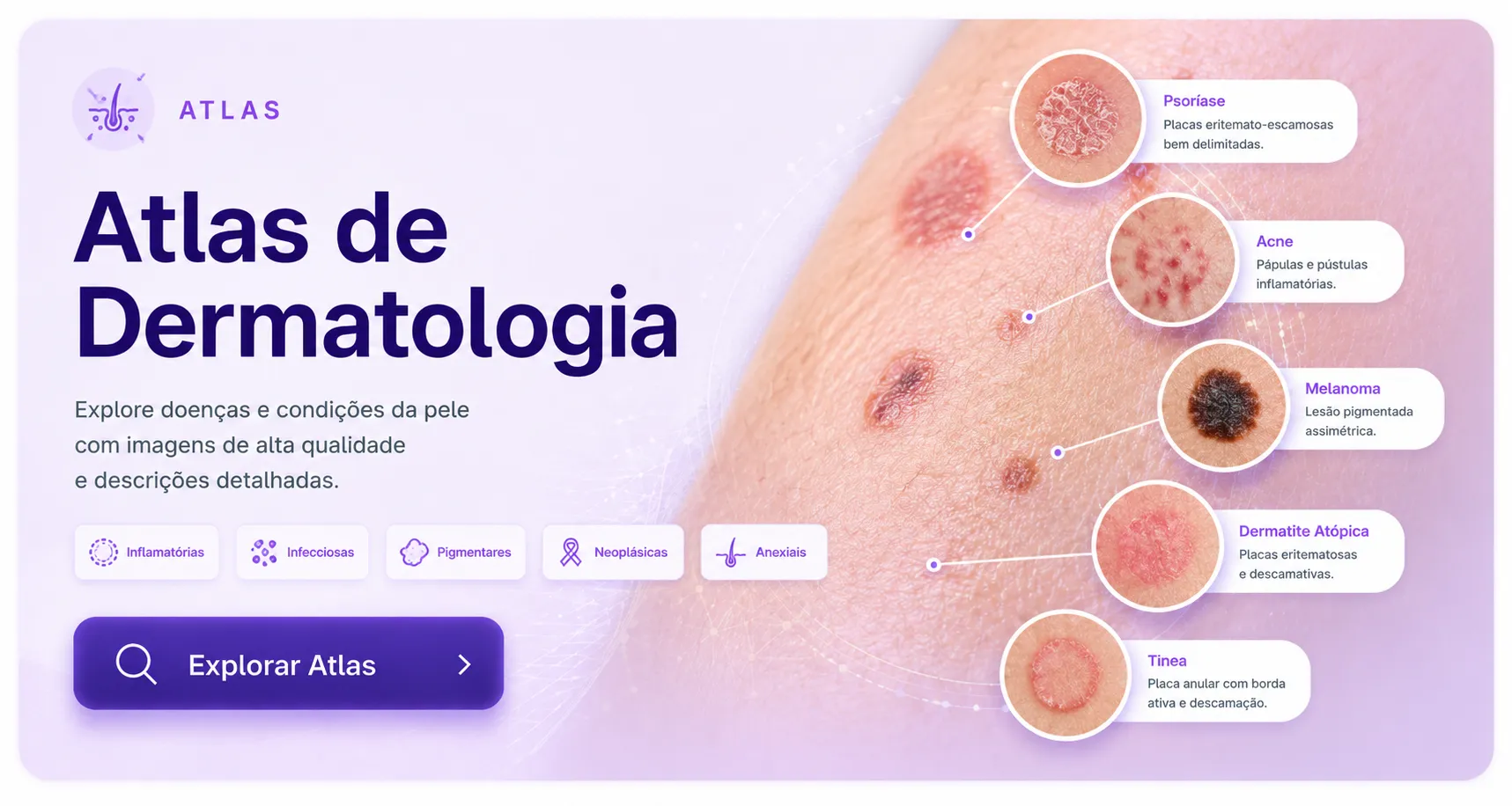 Atlas de Dermatologia