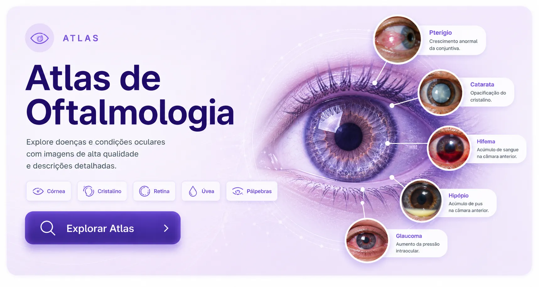 Atlas de Oftalmologia