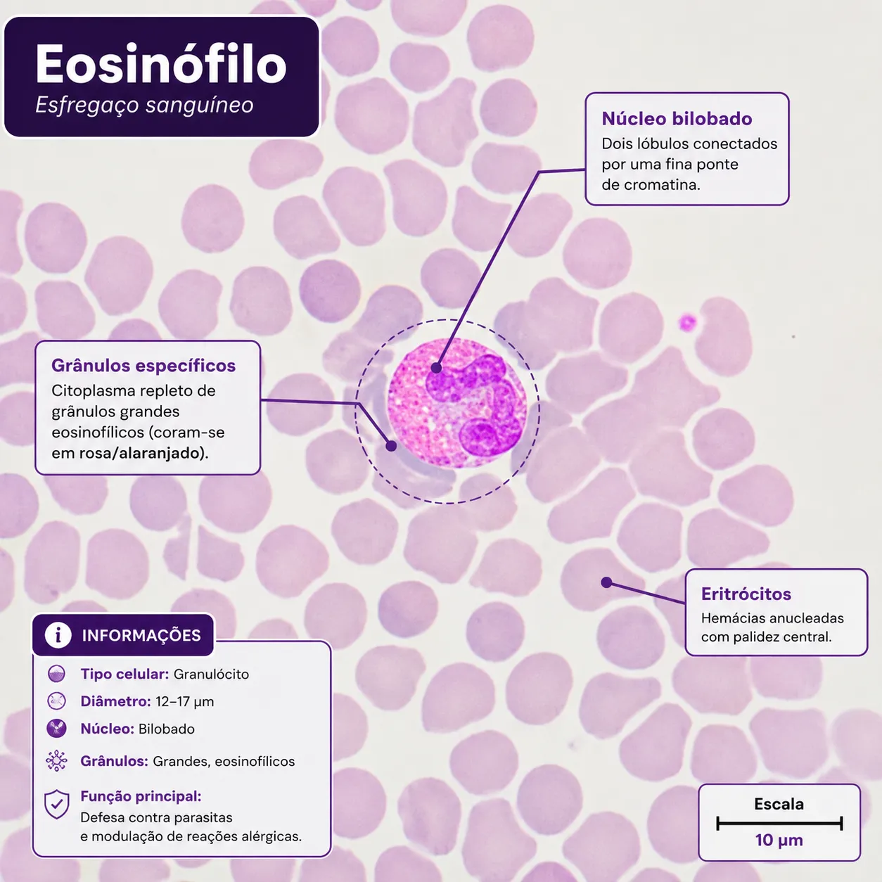 Eosinófilo em esfregaço sanguíneo — imagem 1