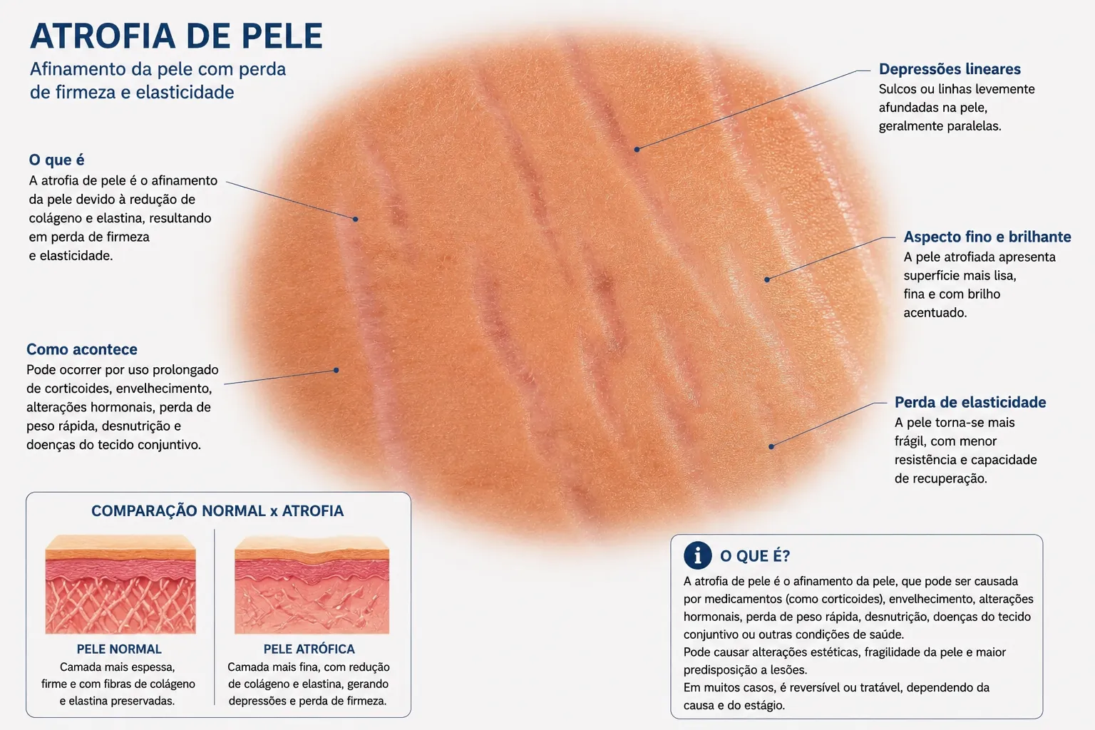 Estruturas em destaque da atrofia de pele