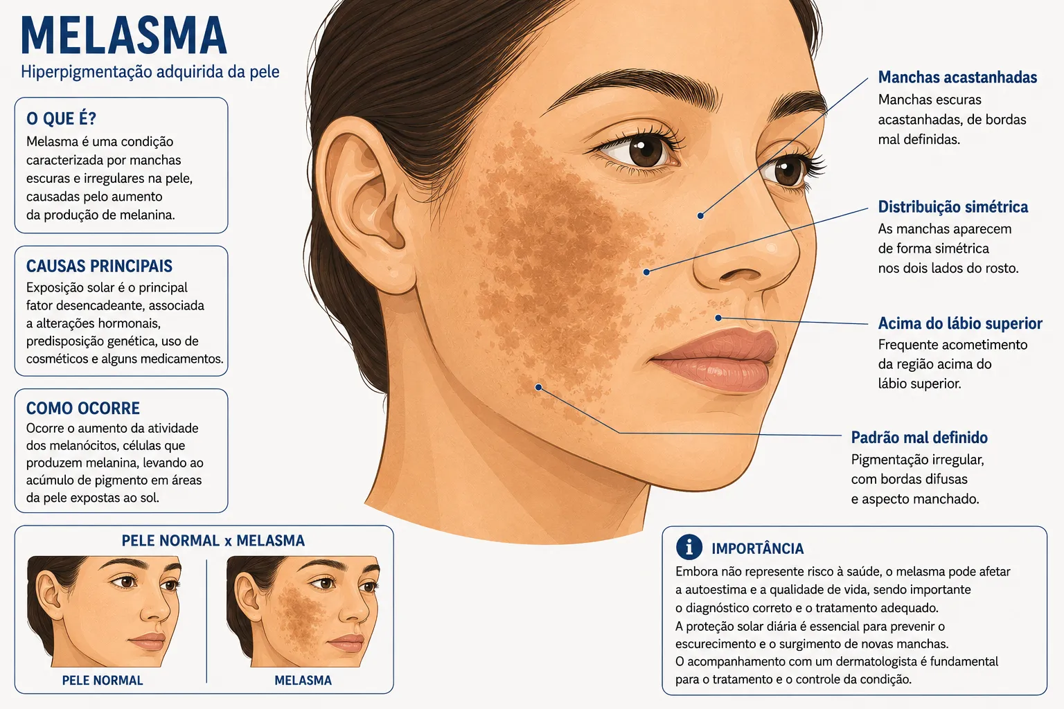 Estruturas em destaque do melasma