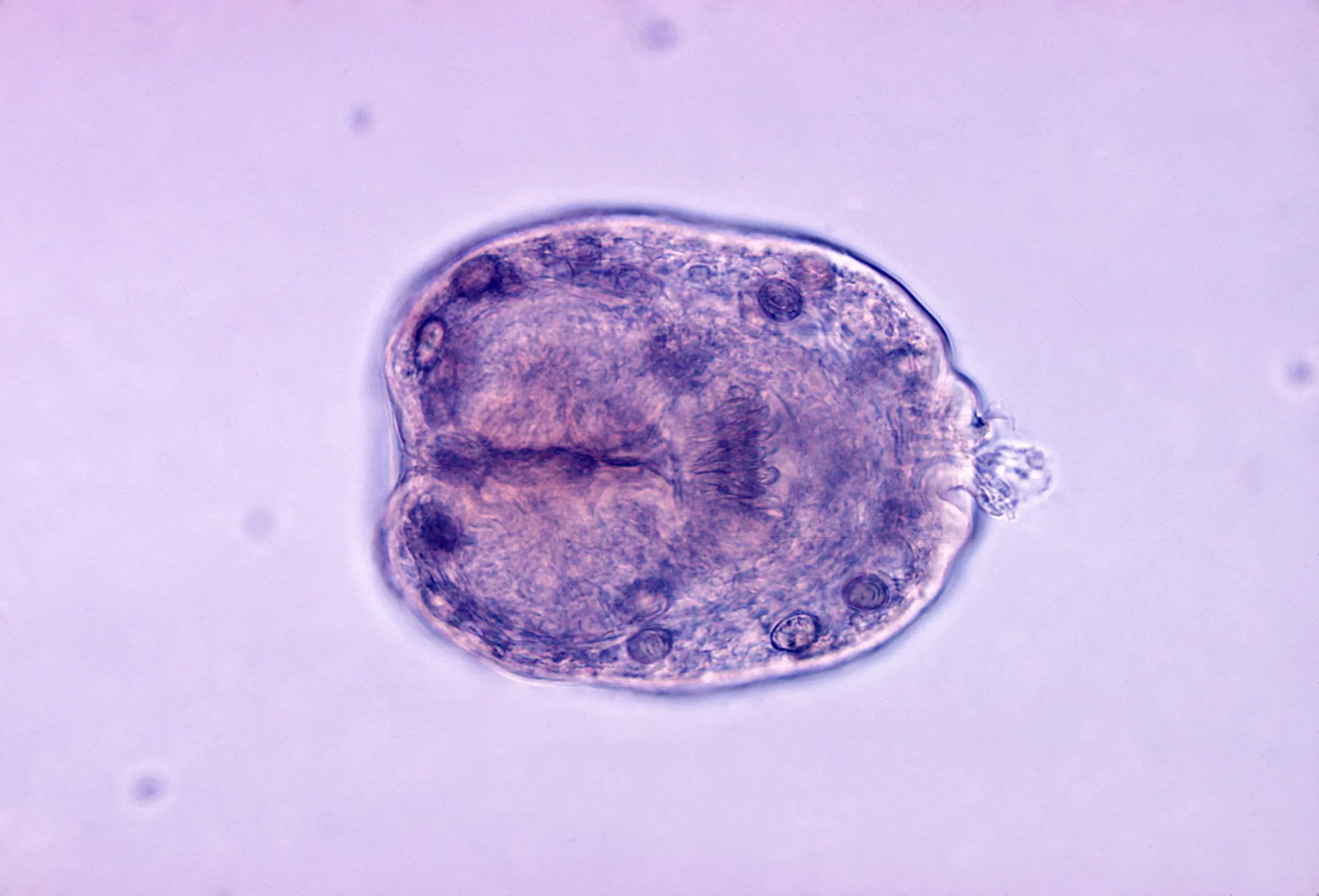 Agente etiológico da hidatidose - Echinococcus