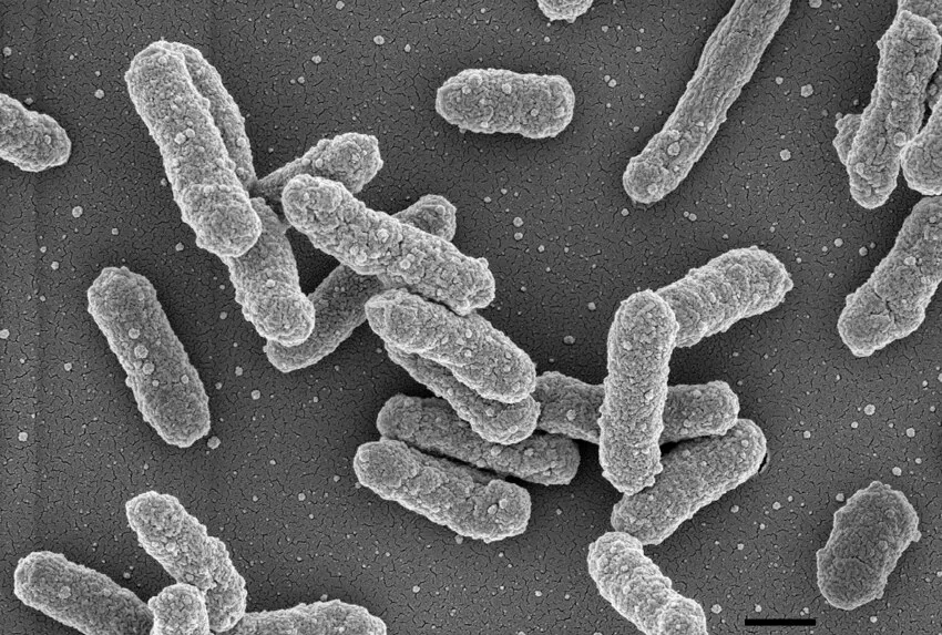 Yersinia pestis