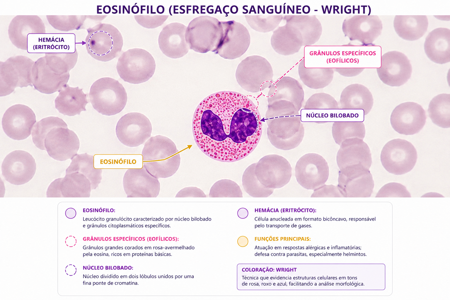 Eosinófilo em esfregaço sanguíneo