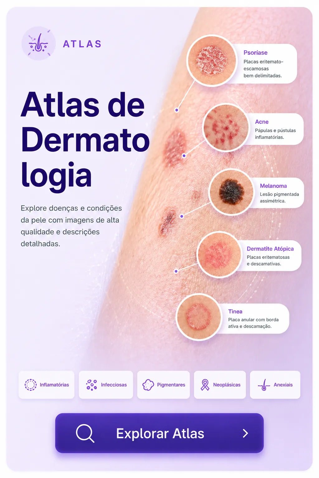 Atlas de Dermatologia