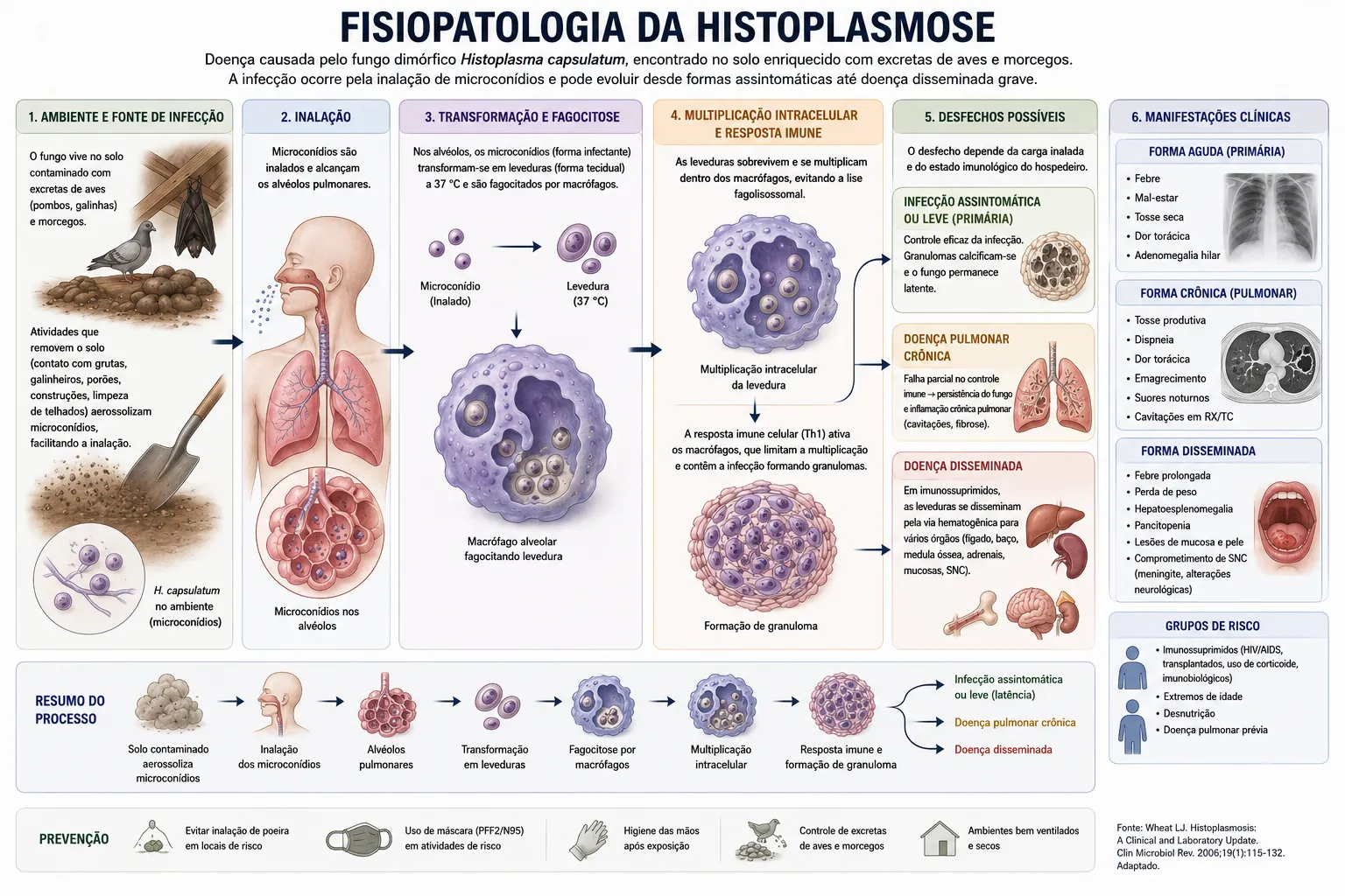 Fisiopatologia da histoplasmose desde a inalação até as formas clínicas