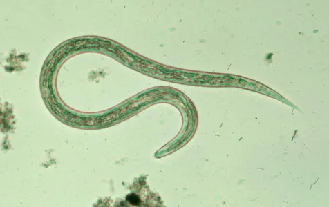 Histologia da ancilostomose