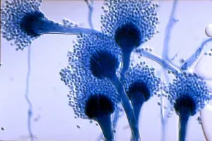 Histologia de Aspergillus spp.