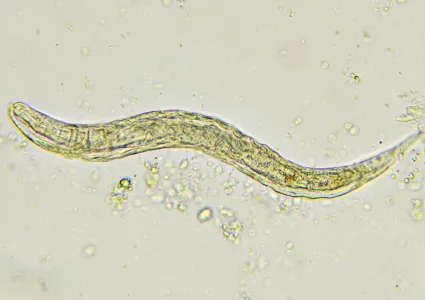 Histologia da estrongiloidíase por Strongyloides stercoralis