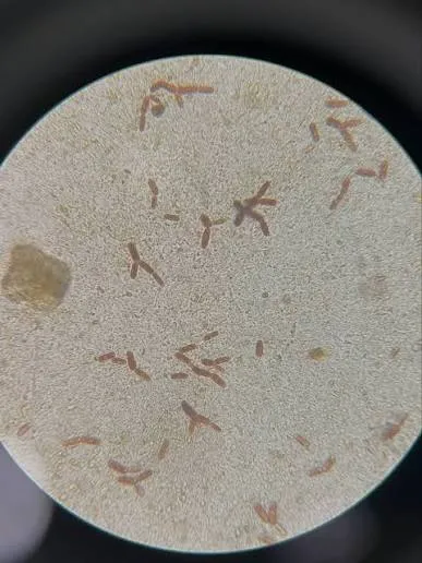 Microscopia e morfologia associadas à geotricose