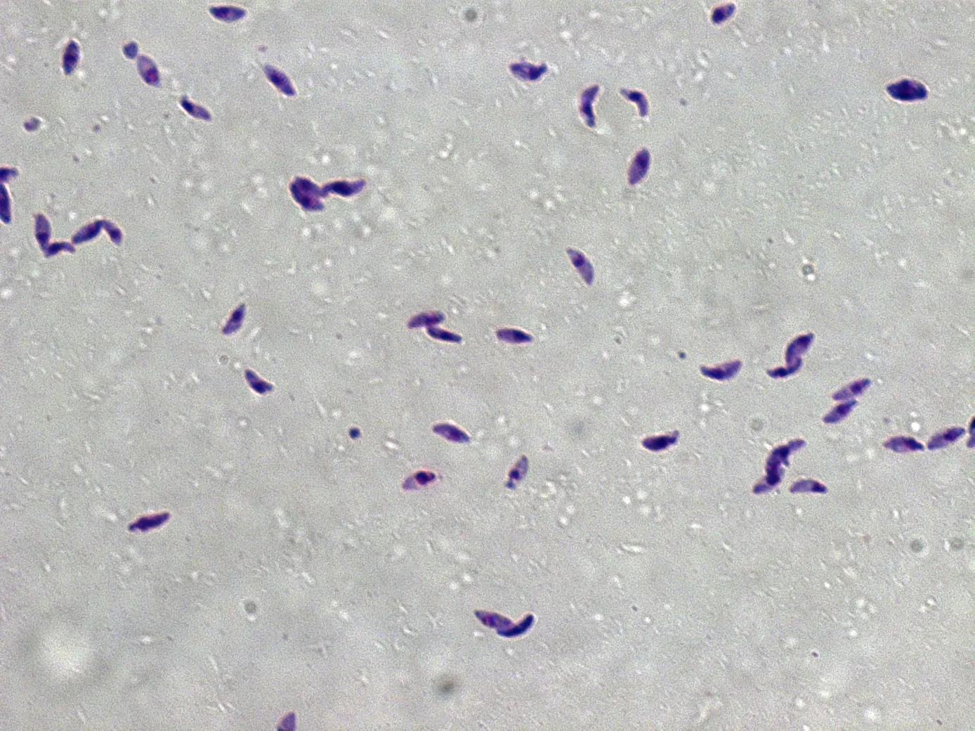 Toxoplasma gondii — imagem histológica